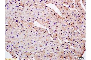 anti-Parkinson Protein 7 (PARK7) (AA 101-189) antibody