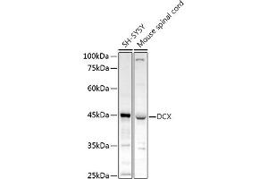 Western blot analysis of extracts of various cell lines, using DCX antibody (ABIN3021509, ABIN3021510, ABIN3021511 and ABIN6215166) at 1:1000 dilution.