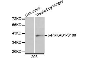 Western blot analysis of extracts of 293 cells, using Phospho-AMPKβ1-S108 antibody.