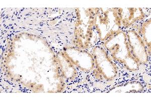 Detection of RPS6Kb1 in Human Kidney Tissue using Polyclonal Antibody to Ribosomal Protein S6 Kinase Beta 1 (RPS6Kb1)