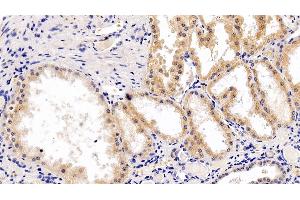 Detection of RPS6Kb1 in Human Kidney Tissue using Polyclonal Antibody to Ribosomal Protein S6 Kinase Beta 1 (RPS6Kb1) (RPS6KB1 anticorps  (AA 91-352))