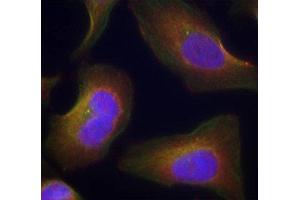 Immunofluorescence staining of methanol-fixed Hela cells using Phospho-PRKCQ-S676 antibody. (PKC theta anticorps  (pSer676))