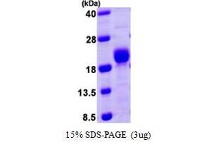 SDS-PAGE (SDS) image for Protein Phosphatase 3, Regulatory Subunit B, alpha (PPP3R1) (AA 1-170) protein (His tag) (ABIN666631)