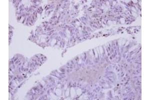 Image no. 3 for anti-COP9 Signalosome Complex Subunit 3 (COPS3) (AA 139-390) antibody (ABIN1497573)