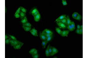 Immunofluorescence staining of HepG2 cells with ABIN7152277 at 1:135, counter-stained with DAPI. (Exopolyphosphatase PRUNE1 (PRUNE1) (AA 1-168) anticorps)