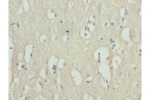 Immunohistochemistry of paraffin-embedded human brain tissue using ABIN7166851 at dilution of 1:100 (RHPN1-AS1 anticorps  (AA 1-59))