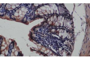 Immunohistochemistry of paraffin-embedded Rat colon using CK-19 Polyclonal Antibody at dilution of 1:50