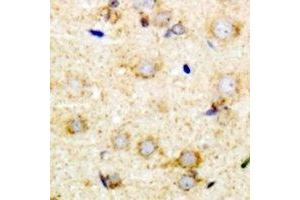Immunohistochemical analysis of Pumilio 1 staining in mouse brain formalin fixed paraffin embedded tissue section. (PUM1 anticorps)