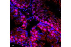 Immunofluorescence of paraffin embedded mouse testis using DMRTA2 (ABIN7073753) at dilution of 1: 650 (400x lens)