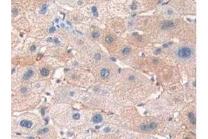 IHC-P analysis of Human Liver Tissue, with DAB staining. (ERBB3 anticorps  (AA 709-966))