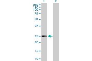 Western Blot analysis of CCBL1 expression in transfected 293T cell line by CCBL1 MaxPab polyclonal antibody. (CCBL1 anticorps  (AA 1-250))