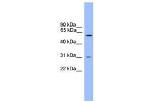 Image no. 1 for anti-Proprotein Convertase Subtilisin/kexin Type 2 (PCSK2) (AA 351-400) antibody (ABIN6746608) (PCSK2 anticorps  (AA 351-400))