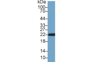 Western Blot; Sample: Rat Skin lysate; Primary Ab: 1µg/ml Rabbit Anti-Rat CYPB Antibody Second Ab: 0.
