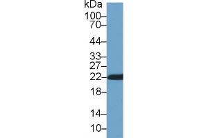 Western Blot; Sample: Rat Skin lysate; Primary Ab: 1µg/ml Rabbit Anti-Rat CYPB Antibody Second Ab: 0. (PPIB anticorps  (AA 34-216))