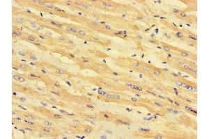 Immunohistochemistry of paraffin-embedded human heart tissue using ABIN7158953 at dilution of 1:100