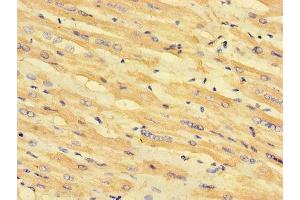 Immunohistochemistry of paraffin-embedded human heart tissue using ABIN7158953 at dilution of 1:100 (MLYCD anticorps  (AA 40-493))