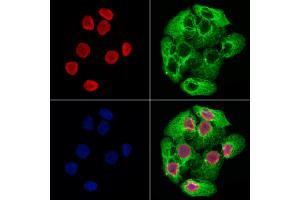 ABIN6265232 and ABIN6278671 staining Hela cells by IF/ICC. (SOX12 anticorps  (Internal Region))