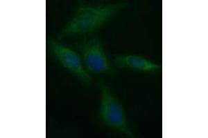 Image no. 2 for anti-Tyrosine Hydroxylase (TH) antibody (ABIN1501369) (Tyrosine Hydroxylase anticorps)
