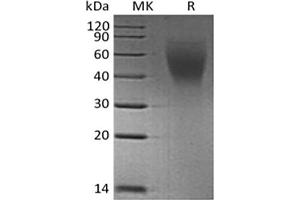 Western Blotting (WB) image for Mucin 16, Cell Surface Associated (CA125) (Active) protein (His tag) (ABIN7319764) (MUC16 Protein (His tag))