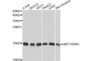 Western blot analysis of extracts of various cell lines, using HIST1H2BG antibody (ABIN6003628) at 1/1000 dilution. (HIST1H2BG anticorps)