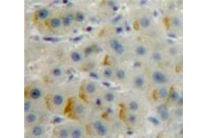Used in DAB staining on fromalin fixed paraffin-embedded Liver tissue