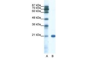 SSX2 antibody used at 0. (SSX2 anticorps  (C-Term))