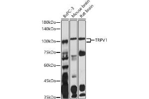 Western blot analysis of extracts of various cell lines, using TRPV1 antibody (ABIN6133947, ABIN6149596, ABIN6149597 and ABIN6224662) at 1:1000 dilution. (TRPV1 anticorps  (AA 400-500))