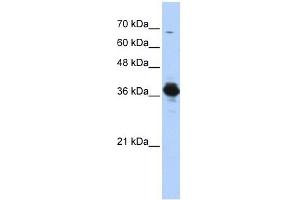 ATP6V0D2 antibody used at 1 ug/ml to detect target protein.