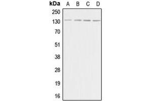Western blot analysis of Adenylate Cyclase 5/6 expression in HeLa (A), Raw264. (ADCY5/6 anticorps  (C-Term))