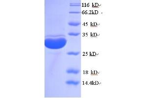 SDS-PAGE (SDS) image for CD68 Molecule (CD68) (AA 21-291), (Extracellular) protein (His tag) (ABIN5713338)