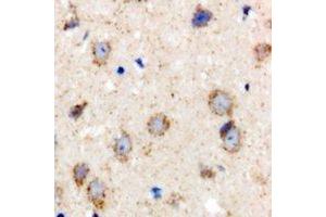 Immunohistochemical analysis of BCS1L staining in rat brain formalin fixed paraffin embedded tissue section. (BCS1L anticorps)