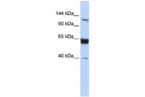 WB Suggested Anti-SYCP1 Antibody Titration: 0. (SYCP1 anticorps  (N-Term))
