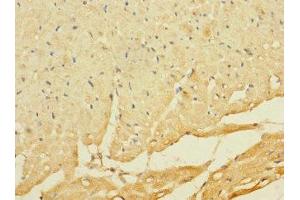 Immunohistochemistry of paraffin-embedded human heart tissue using ABIN7174908 at dilution of 1:100 (C8ORF74 anticorps  (AA 1-294))