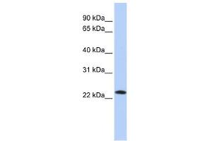 SDF2 antibody used at 1 ug/ml to detect target protein. (SDF2 anticorps  (Middle Region))