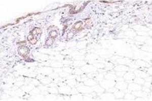 Immunohistochemistry analysis of paraffin-embedded mouse skin using,ECRG-2 (ABIN7075552) at dilution of 1: 2600 (SPINK7/ECRG2 anticorps)