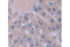 Used in DAB staining on fromalin fixed paraffin- embedded liver tissue