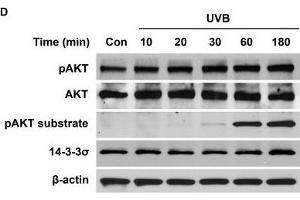 AKT regulates UVB-mediated nuclear translocation of TC45 in keratinocytesA.