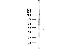 anti-Endonuclease 8-like 2 (NEIL2) (Internal Region) antibody