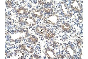 Arginase 1 antibody was used for immunohistochemistry at a concentration of 4-8 ug/ml. (Liver Arginase anticorps  (Arg1, N-Term))