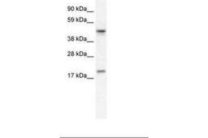 Image no. 1 for anti-Programmed Cell Death 4 (PDCD4) (N-Term) antibody (ABIN6735963) (PDCD4 anticorps  (N-Term))