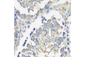 Immunohistochemistry of paraffin-embedded mouse testis using  antibody  at dilution of 1:100 (40x lens).