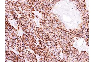 IHC-P Image Immunohistochemical analysis of paraffin-embedded CA922 xenograft, using COX4, antibody at 1:100 dilution.