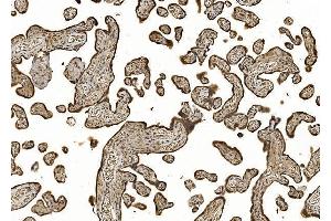 IHC analysis of EIF5 using anti-EIF5 antibody (ABIN7599722). (EIF5 anticorps  (AA 11-423))
