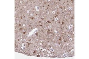Immunohistochemical staining (Formalin-fixed paraffin-embedded sections) of human cerebral cortex with DCLK2 polyclonal antibody  shows moderate cytoplasmic positivity in neuronal cells at 1:50-1:200 dilution. (DCLK2 anticorps)