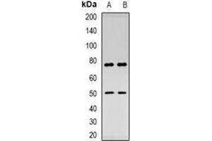 Western blot analysis of Thymopoietin expression in HepG2 (A), mouse kidney (B) whole cell lysates. (Thymopoietin anticorps  (N-Term))