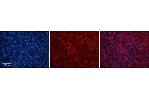 Rabbit Anti-RPE Antibody  Catalog Number: ARP56726_P050 Formalin Fixed Paraffin Embedded Tissue: Human Adult Liver  Observed Staining: Cytoplasm in hepatocytes, strong signal, wide tissue distribution Primary Antibody Concentration: 1:100 Secondary Antibody: Donkey anti-Rabbit-Cy3 Secondary Antibody Concentration: 1:200 Magnification: 20X Exposure Time: 0.