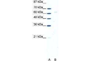 WB Suggested Anti-FOXN1 Antibody Titration: 5. (FOXN1 anticorps  (N-Term))