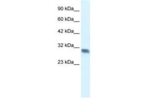 Western Blotting (WB) image for anti-Four and A Half LIM Domains 2 (FHL2) antibody (ABIN2460972) (FHL2 anticorps)