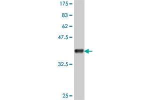 Western Blot detection against Immunogen (37. (CACUL1 anticorps  (AA 111-210))