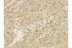MYLK2 Mouse Monoclonal Antibody at 1/100 staining mouse heart tissue by IHC-P. (MYLK2 anticorps  (Internal Region))
